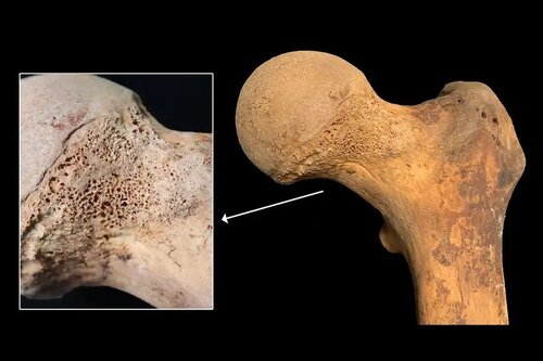 Unveiling the Past: Unraveling Pre-Modern Human History with the First-Ever Discovery of Cannabis Traces in Ancient Bones