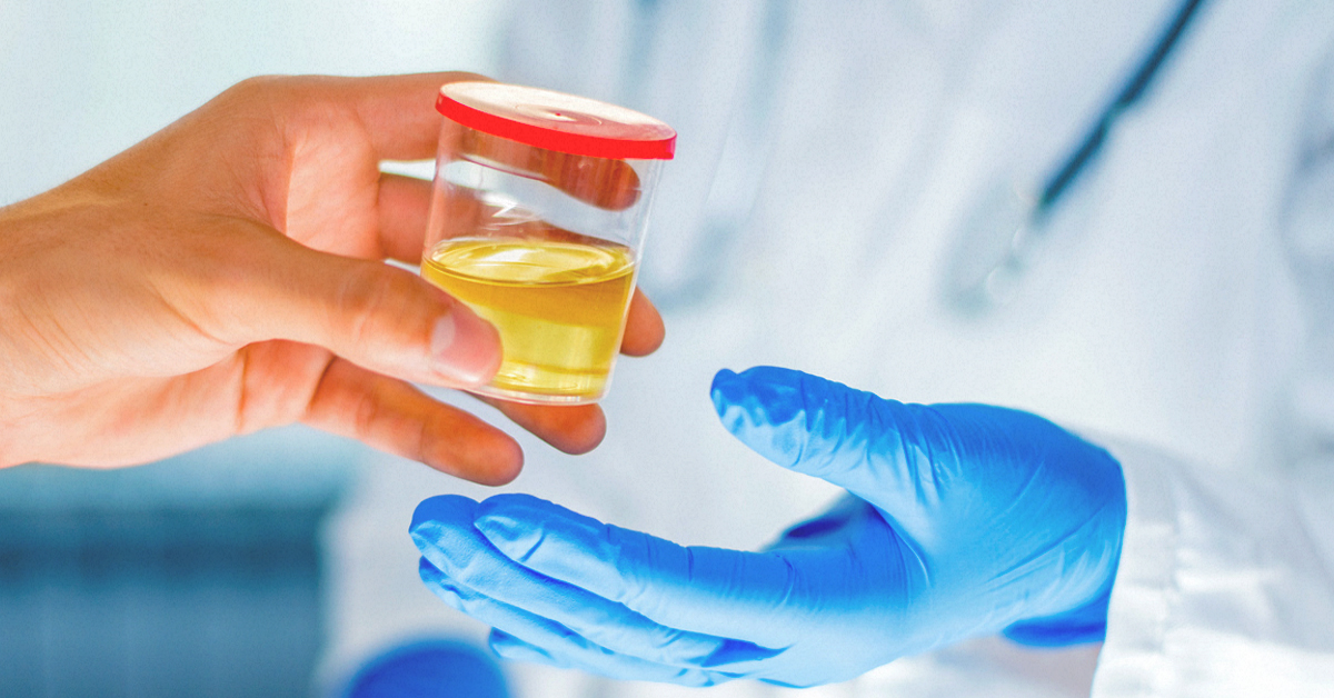 Drug Test for Weed: How to Pass a Urine Test?